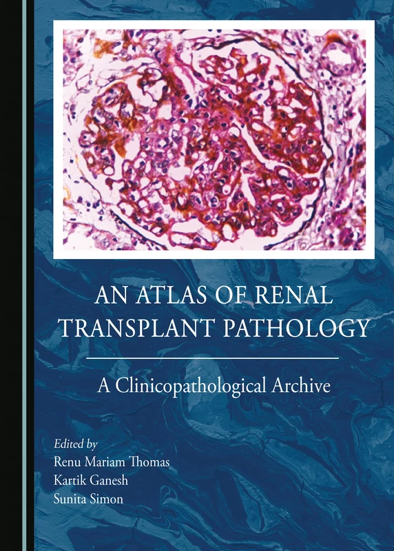 An Atlas of Renal Transplant Pathology: A Clinicopathological Archive