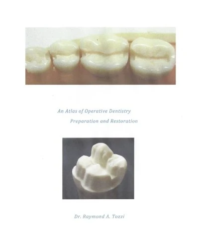 An Atlas of Operative Dentistry Preparation and Restoration