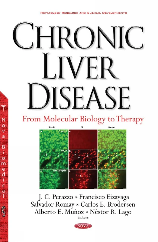 Chronic Liver Disease: From Molecular Biology to Therapy (Hepatology Research and Clinical Developments)