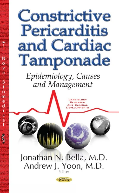Constrictive Pericarditis & Cardiac Tamponade: Epidemiology, Causes & Management