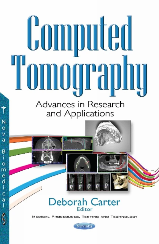 Computed Tomography: Advances in Research & Applications (Medical Procedures, Testing and Technology)