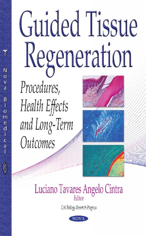 Guided Tissue Regeneration: Procedures, Health Effects & Long-Term Outcomes