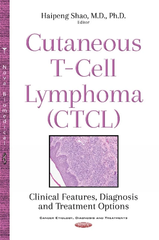Cutaneous T-Cell Lymphoma (CTCL): Clinical Features, Diagnosis & Treatment Options