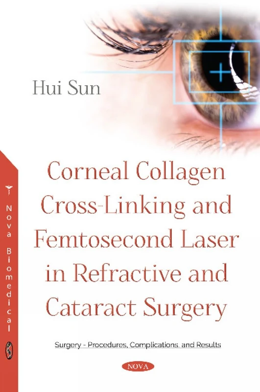 Corneal Collagen Cross-Linking and Femtosecond Laser in Refractive and Cataract Surgery (Surgery - Procedures, Complication, and Results: Eye and Vision Research Developments)