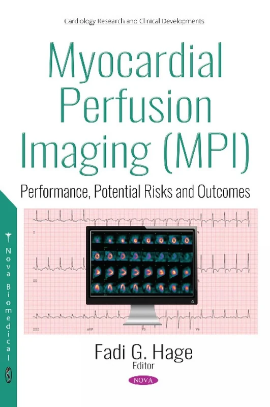 Myocardial Perfusion Imaging (MPI): Performance, Potential Risks and Outcomes (Cardiology Research and Clinical Developments)
