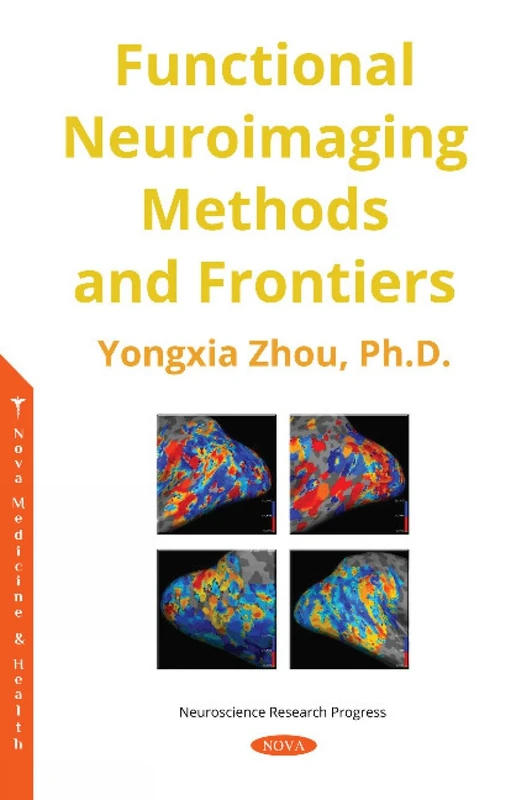 Functional Neuroimaging Methods and Frontiers (Neuroscience Research Progress)