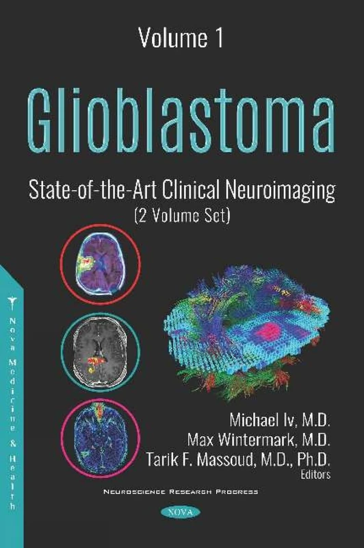 Glioblastoma: State-of-the-Art Clinical Neuroimaging (2 Volume Set) (Neuroscience Research Progress)
