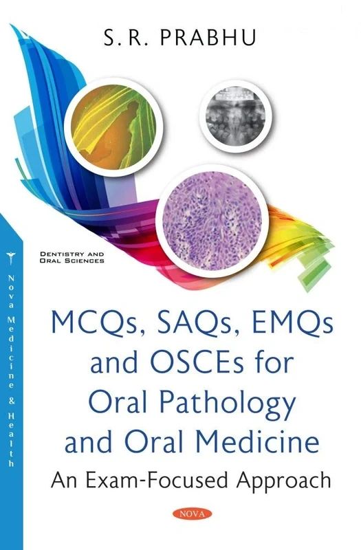 MCQs, SAQs, EMQs and OSCEs for Oral Pathology and Oral Medicine: An Exam-Focused Approach (Dentistry and Oral Sciences)