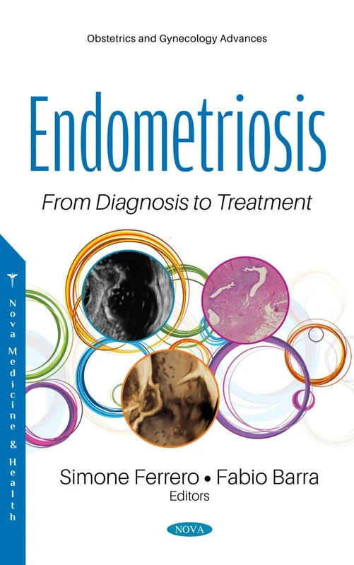 Endometriosis: From Diagnosis to Treatment - Medical Book