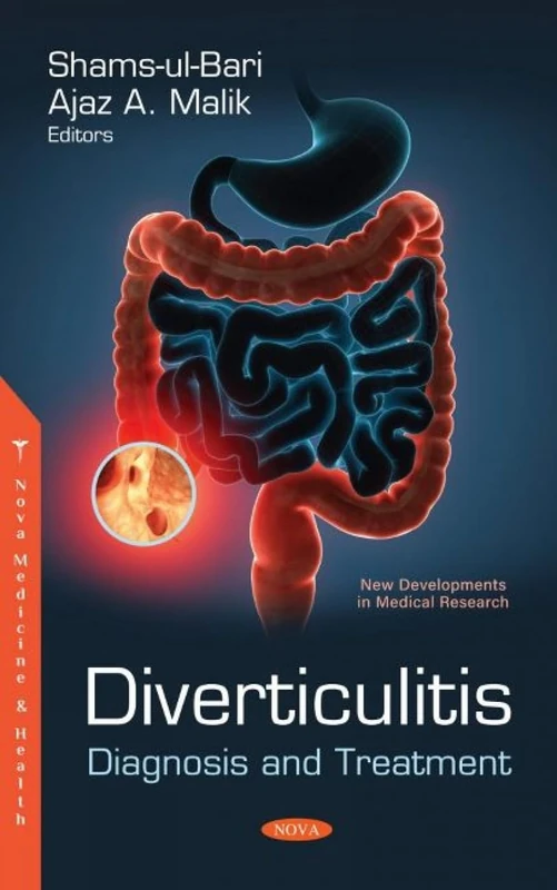 Diverticulitis: Diagnosis and Treatment (New Developments in Medical Research)