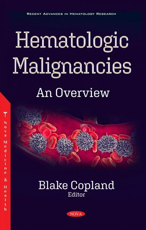 Hematologic Malignancies: An Overview - Hematology Research