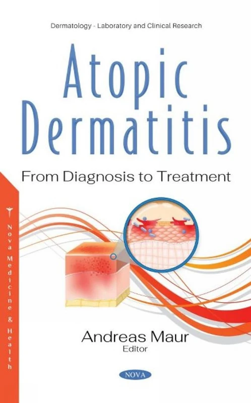 Atopic Dermatitis: From Diagnosis to Treatment - Image 1