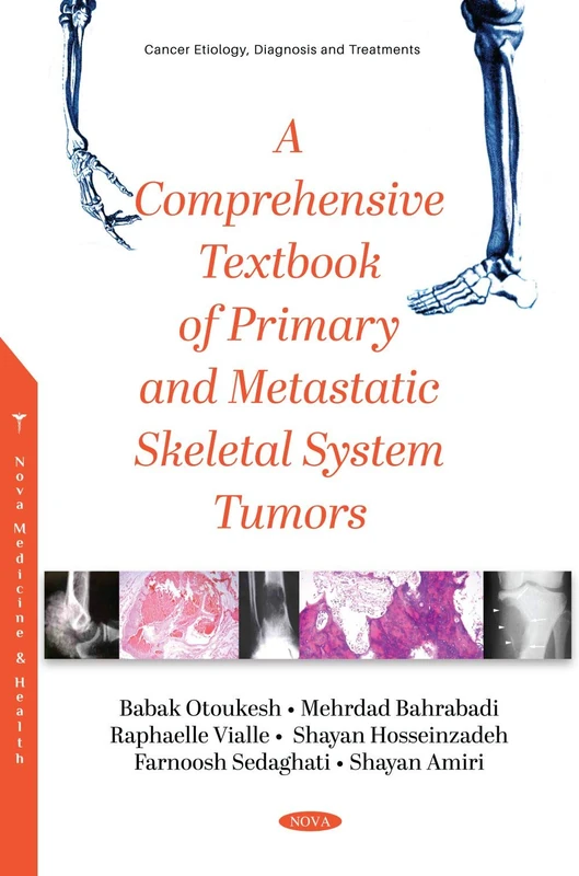 A Comprehensive Textbook of Primary and Metastatic Tumors of the Skeletal System (Cancer Etiology, Diagnosis and Treatments)