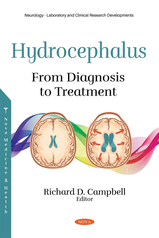 Hydrocephalus: From Diagnosis to Treatment (Neurology - Laboratory and Clinical Research Developments)