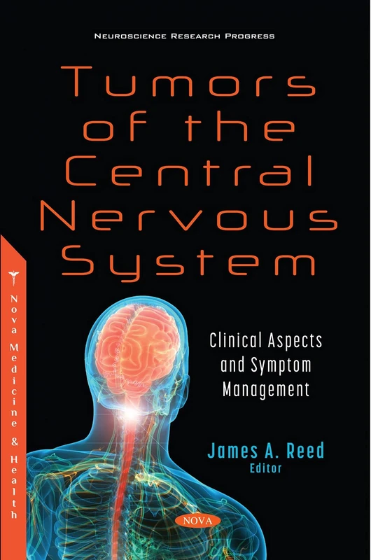 Tumors of the Central Nervous System: Clinical Aspects and Symptom Management (Neuroscience Research Progress) - Image 1