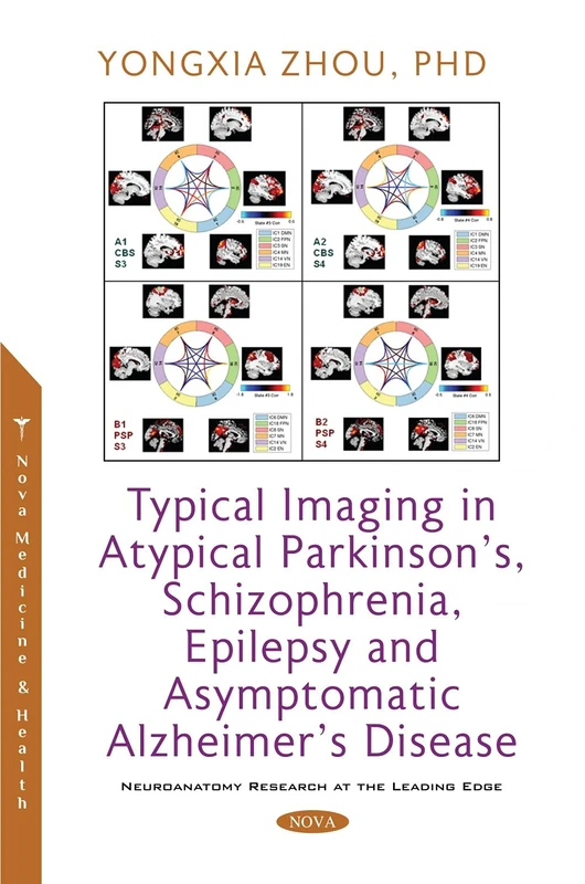 Typical Imaging in Atypical Parkinson's, Schizophrenia, Epilepsy and Asymptomatic Alzheimer's Disease (Neuroanatomy Research at the Leading Edge)