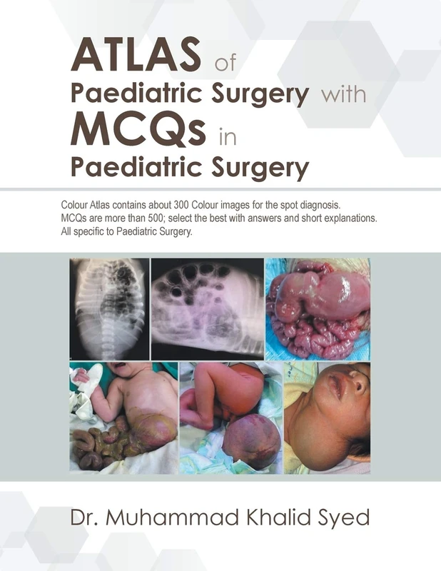 Atlas of Paediatric Surgery with MCQS in Paediatric Surgery