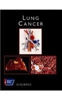 Lung Cancer: ACS Atlas of Clinical Oncology (American Cancer Society Atlas of Clinical Oncology)