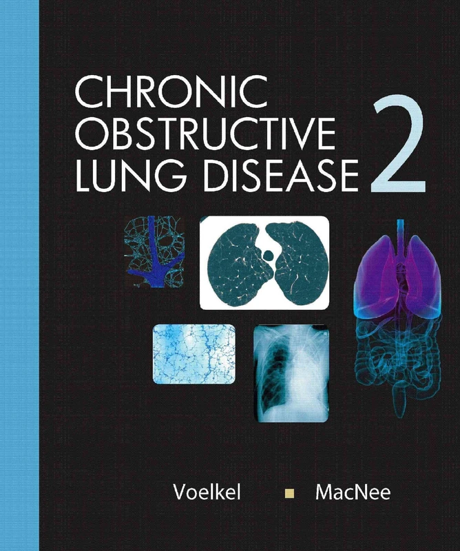 Chronic Obstructive Lung Diseases: 2 (BC DECKER)