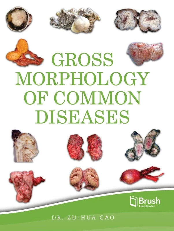 Gross Morphology of Common Diseases