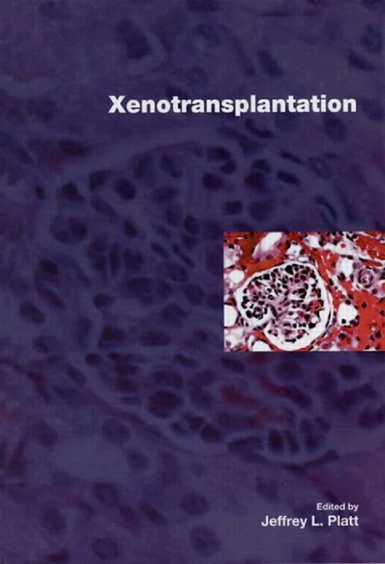 Xenotransplantation - Image 1
