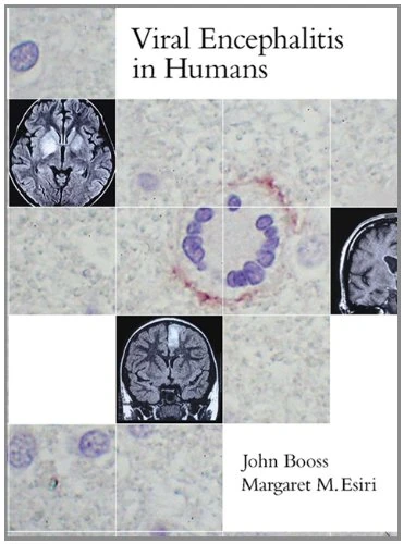 Viral Encephalitis in Humans