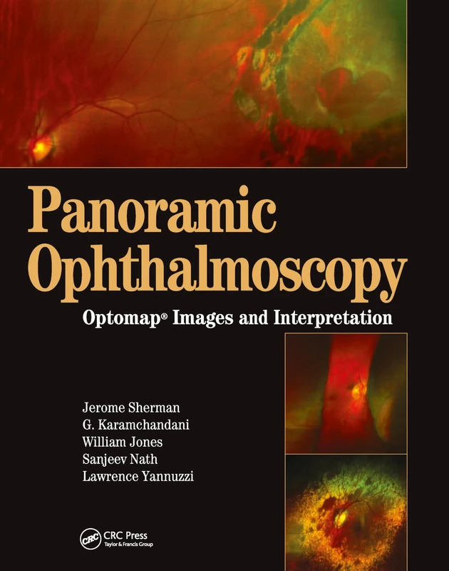 Panoramic Ophthalmoscopy: Optomap Images and Interpretation