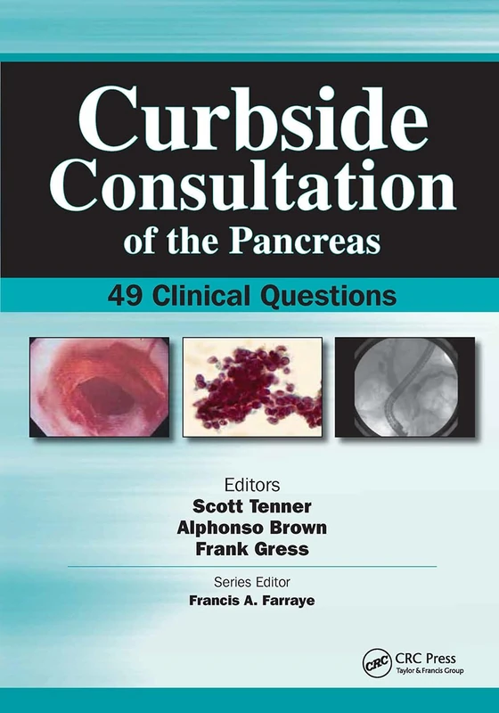 Curbside Consultation of the Pancreas: 49 Clinical Questions (Curbside Consultation in Gastroenterology)