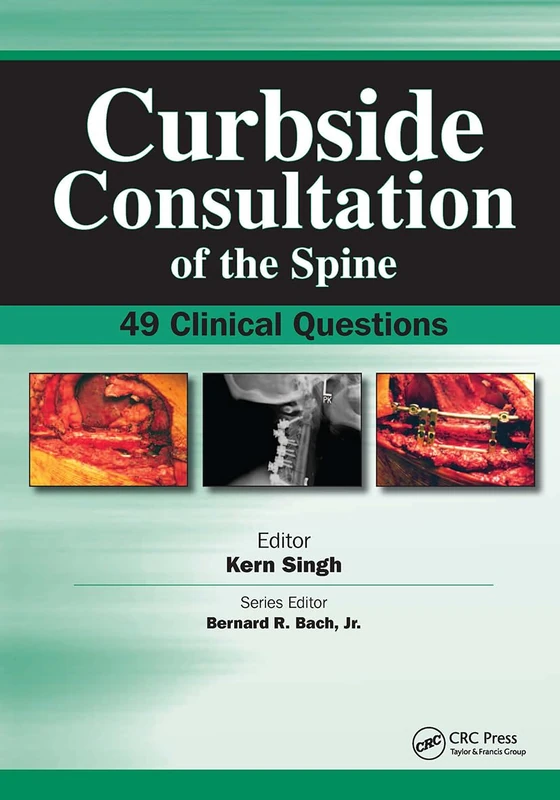 Curbside Consultation of the Spine: 49 Clinical Questions (Curbside Consultation in Orthopedics)