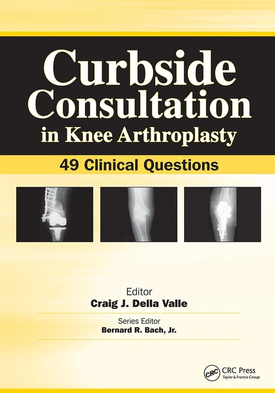Curbside Consultation in Knee Arthroplasty: 49 Clinical Questions (Curbside Consultation in Orthopedics)