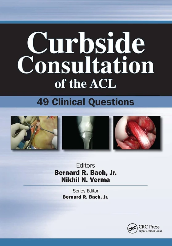 Curbside Consultation of the ACL: 49 Clinical Questions (Curbside Consultation in Orthopedics)