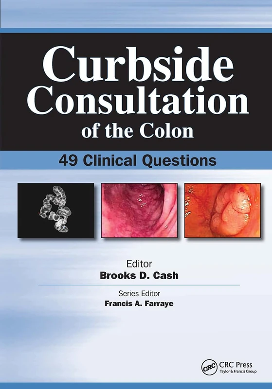 Curbside Consultation of the Colon: 49 Clinical Questions (Curbside Consultation in Gastroenterology)