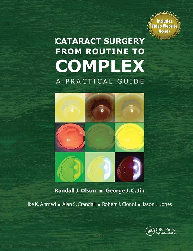 Cataract Surgery from Routine to Complex: A Practical Guide