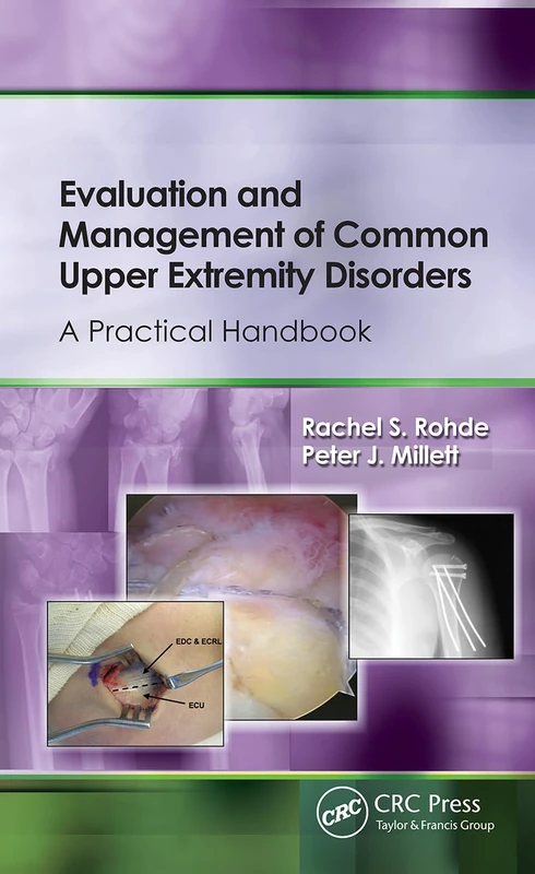 Slack Evaluation and Management of Upper Extremity Disorders