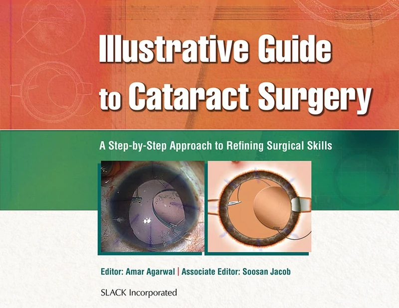 Illustrative Guide to Cataract Surgery: A Step-by-Step Approach to Refining Surgical Skills