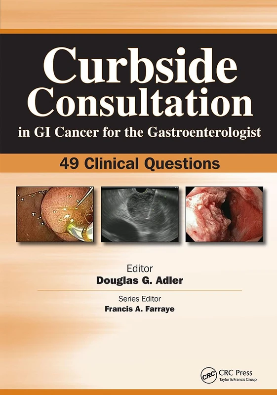 Curbside Consultation in GI Cancer for the Gastroenterologist: 49 Clinical Questions (Curbside Consultation in Gastroenterology)
