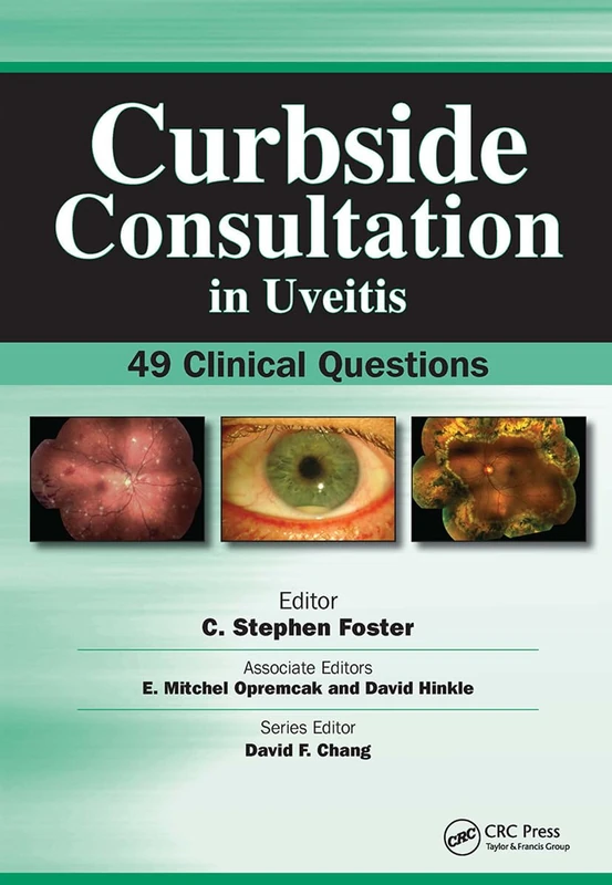 Slack Curbside Consultation in Uveitis - 49 Clinical Questions