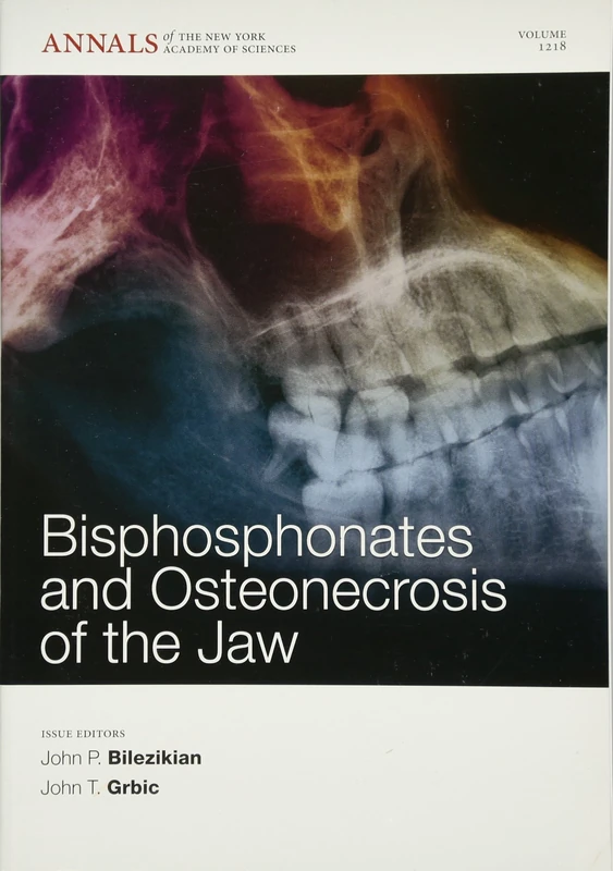 Bisphosphonates and Osteonecrosis of the Jaw, Volume 1218 (Annals of the New York Academy of Sciences)