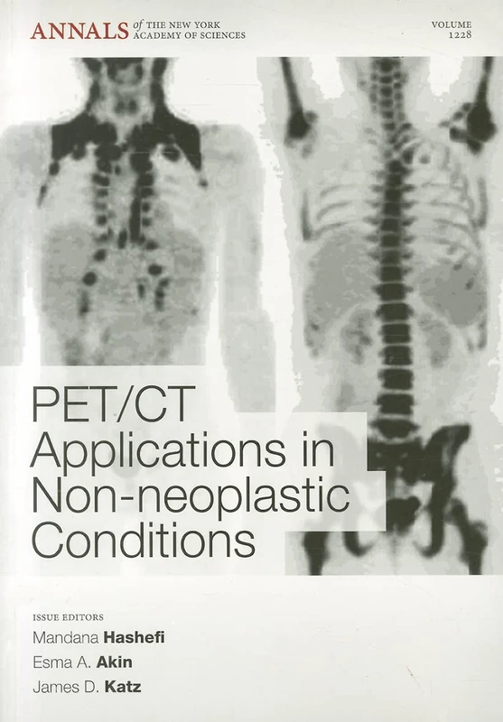 PET CT Applications in Non-Neoplastic Conditions, Volume 1228: 83 (Annals of the New York Academy of Sciences)