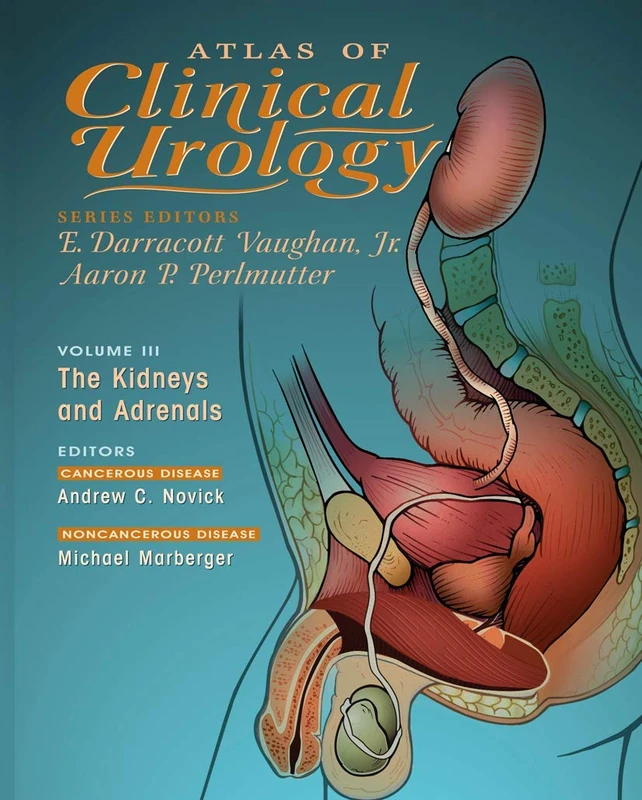 Atlas of Clinical Urology: The Kidneys and Adrenals: 3