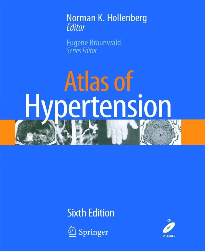 Atlas of Hypertension (Atlas of Heart Diseases)