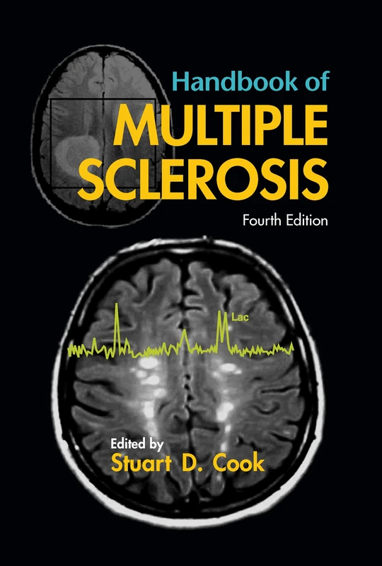 Handbook of Multiple Sclerosis: 80 (Neurological Disease and Therapy)