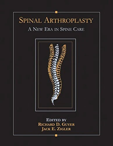 Spinal Arthroplasty: A New Era in Spine Care