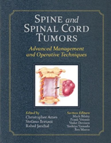 Spine and Spinal Cord Tumors: Advanced Management and Operative Techniques