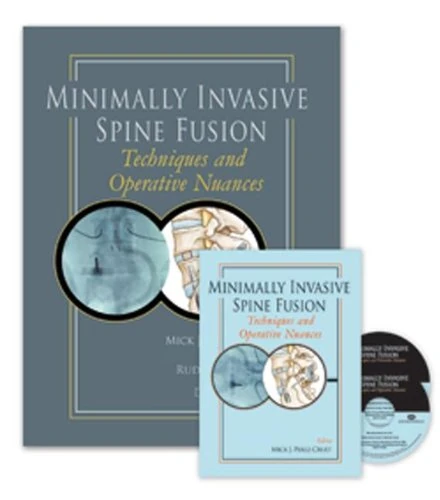 Minimally Invasive Spine Fusion: Techniques and Operative Nuances Book & 2-DVD Set