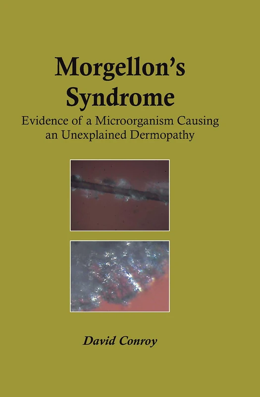 Morgellon's Syndrome: Evidence of a Microorganism Causing an Unexplained Dermopathy - Image 1