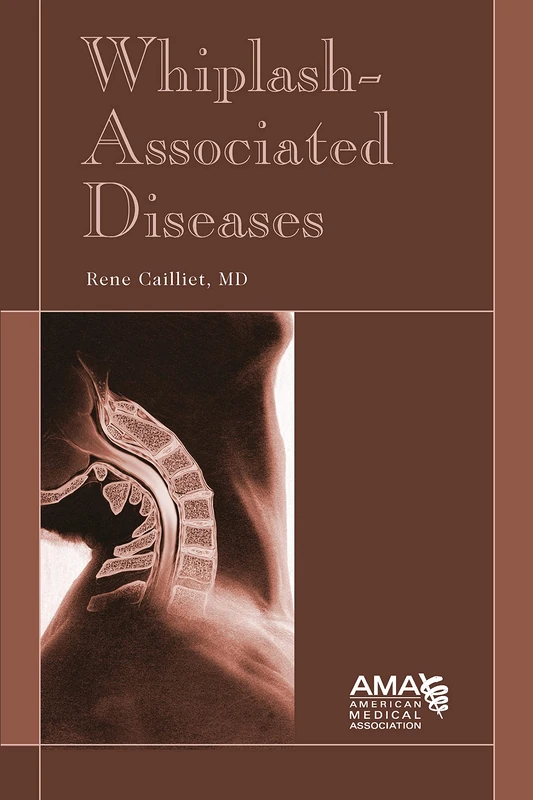 Whiplash-associated Diseases