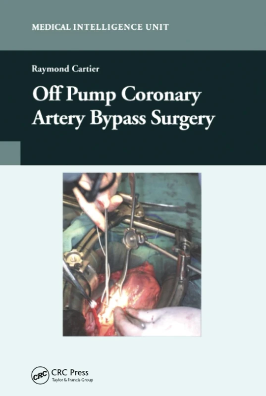 CRC Press Off-Pump Coronary Artery Bypass Surgery Book