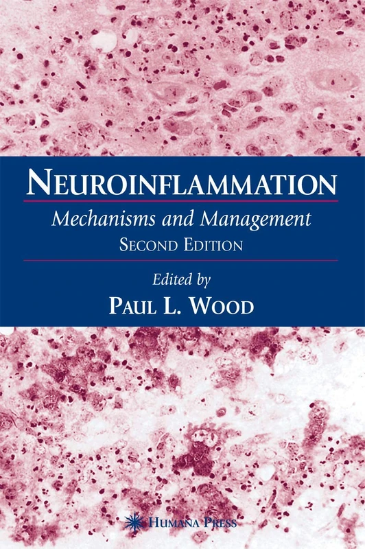 Neuroinflammation: Mechanisms and Management (Contemporary Neuroscience)
