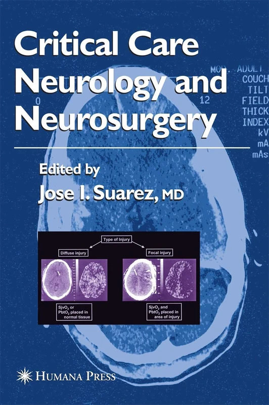Critical Care Neurology and Neurosurgery (Current Clinical Neurology)